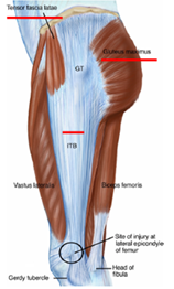 illiotibial band syndrome | Physiostation